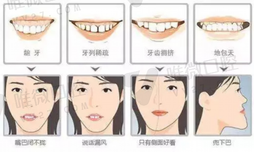 活动假牙和临时牙冠有什么区别,这些事需注意(图1)